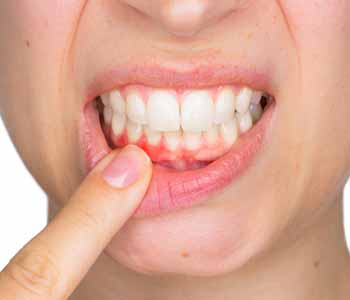 One of the best ways to keep your gums healthy is to see a dentist in Brampton ON.